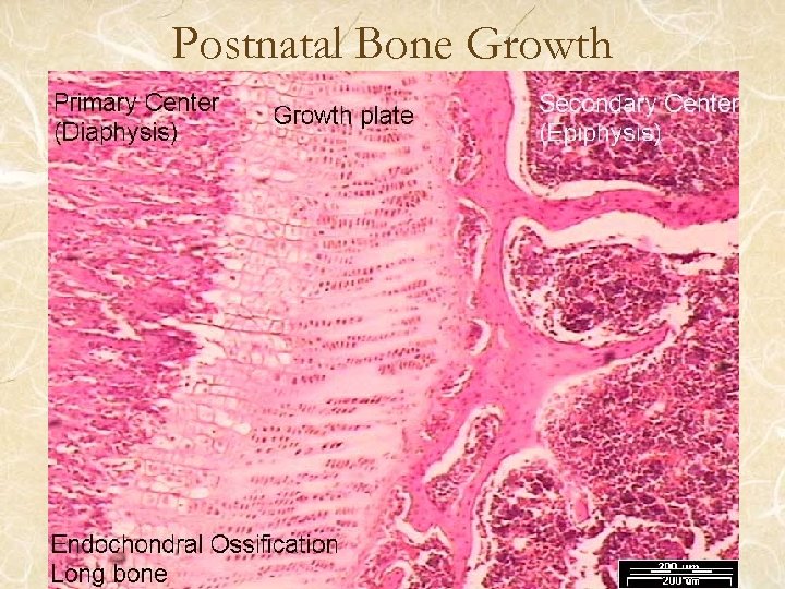 Postnatal Bone Growth 