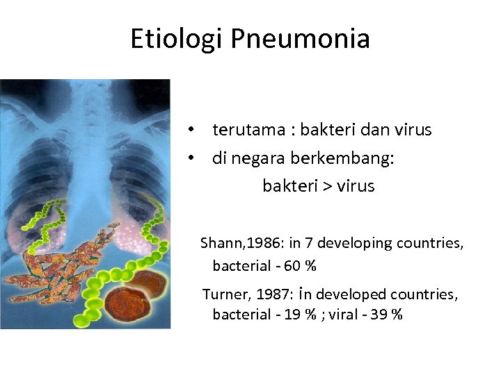 Etiologi Pneumonia • terutama : bakteri dan virus • di negara berkembang: bakteri >