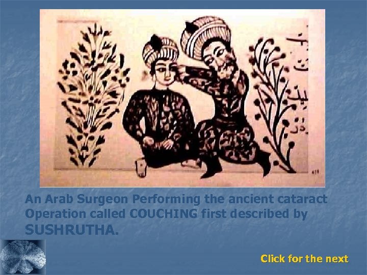 An Arab Surgeon Performing the ancient cataract Operation called COUCHING first described by SUSHRUTHA.