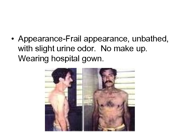  • Appearance-Frail appearance, unbathed, with slight urine odor. No make up. Wearing hospital