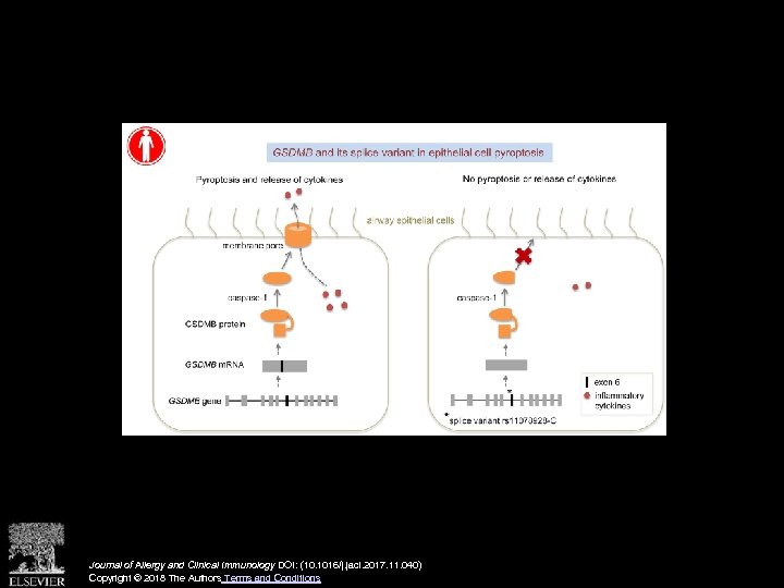 Journal of Allergy and Clinical Immunology DOI: (10. 1016/j. jaci. 2017. 11. 040) Copyright