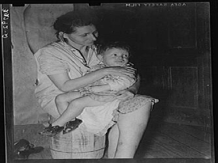 This woman, wife of an ex-farmer now living on relief, had pellagra in an