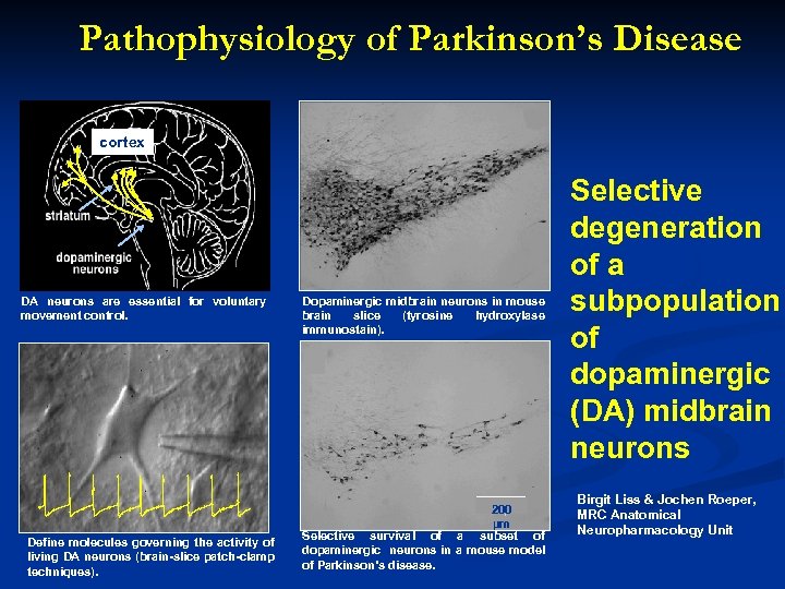 Pathophysiology of Parkinson’s Disease cortex DA neurons are essential for voluntary movement control. Define