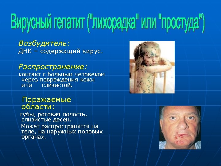 Возбудитель: ДНК – содержащий вирус. Распространение: контакт с больным человеком через повреждения кожи или
