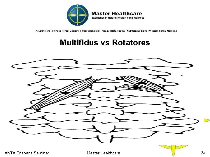 Multifidus vs Rotatores ANTA Brisbane Seminar Master Healthcare 34 