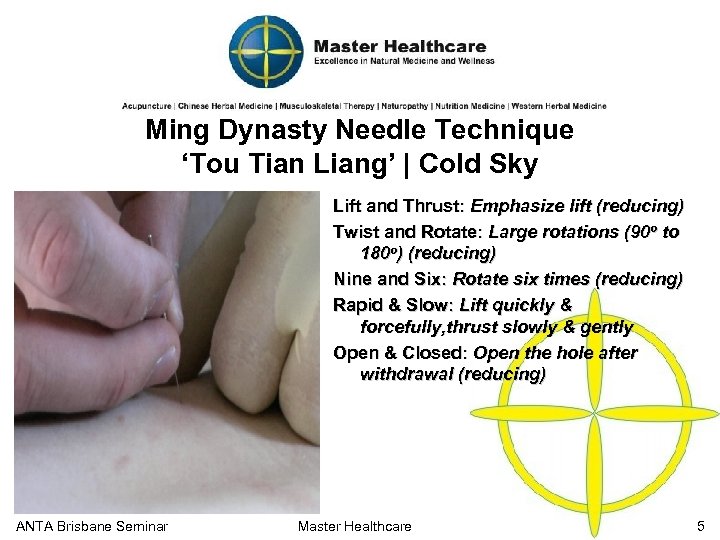 Ming Dynasty Needle Technique ‘Tou Tian Liang’ | Cold Sky Lift and Thrust: Emphasize