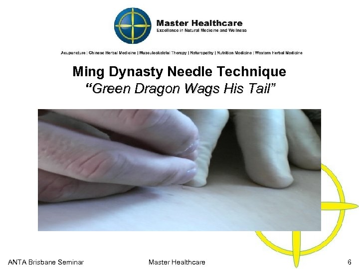 Ming Dynasty Needle Technique “Green Dragon Wags His Tail” ANTA Brisbane Seminar Master Healthcare