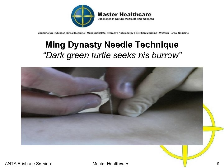 Ming Dynasty Needle Technique “Dark green turtle seeks his burrow” ANTA Brisbane Seminar Master