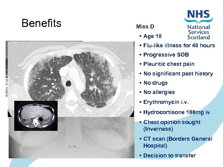 p. 11 Benefits Miss D § Age 18 § Flu-like illness for 48 hours