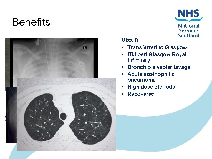 p. 12 Benefits Miss D § Transferred to Glasgow § ITU bed Glasgow Royal