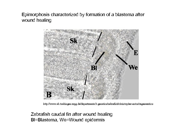 Epimorphosis characterized by formation of a blastema after wound healing http: //www. eb. tuebingen.