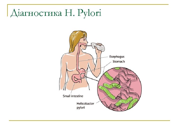 Діагностика H. Pylori 
