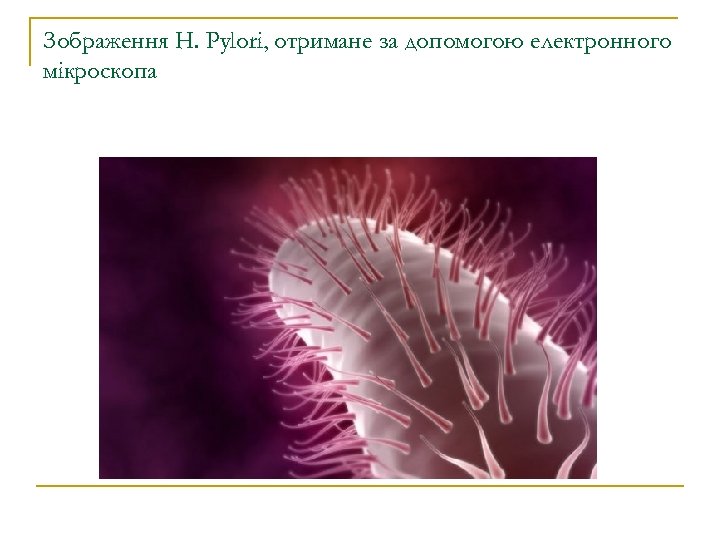 Зображення H. Pylori, отримане за допомогою електронного мікроскопа 