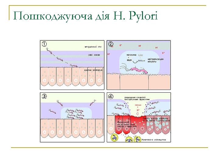 Пошкоджуюча дія H. Pylori 