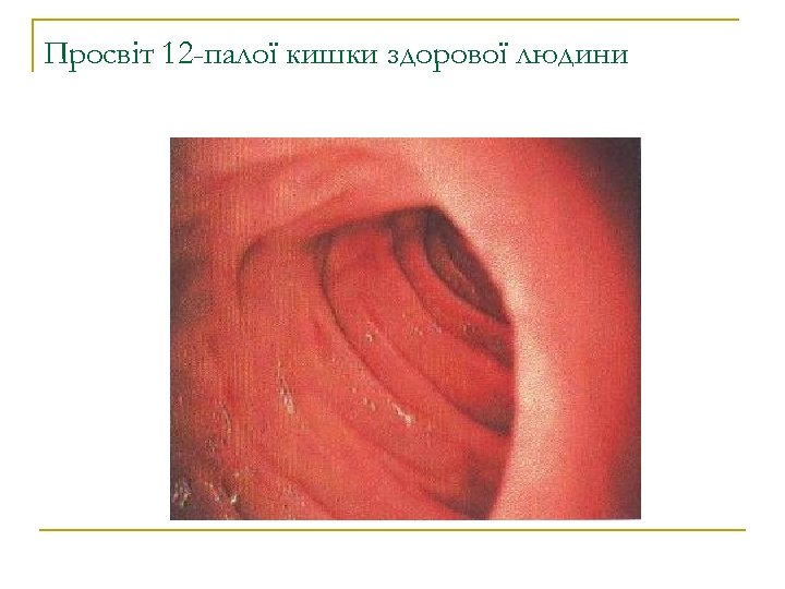Просвіт 12 -палої кишки здорової людини 