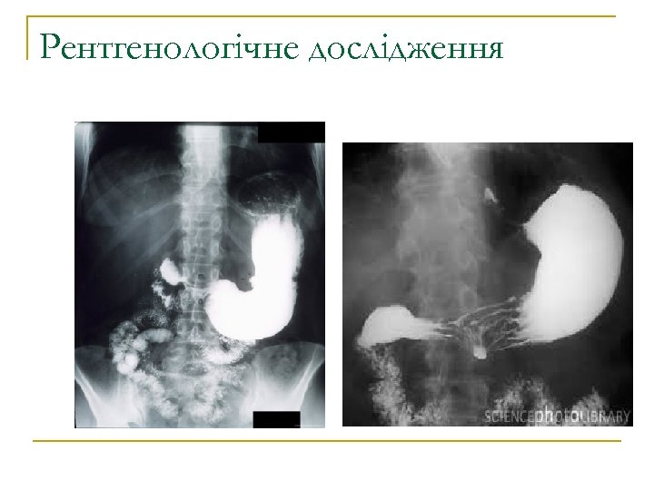 Рентгенологічне дослідження 