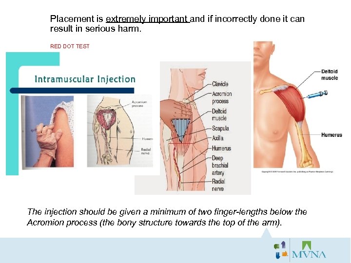 Placement is extremely important and if incorrectly done it can result in serious harm.