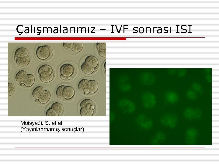 Çalışmalarımız – IVF sonrası ISI Moisyadi, S. et al (Yayınlanmamış sonuçlar) 