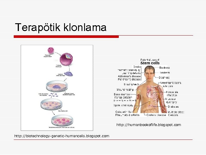 Terapötik klonlama http: //humanbookoflife. blogspot. com http: //biotechnology-genetic-humancells. blogspot. com 