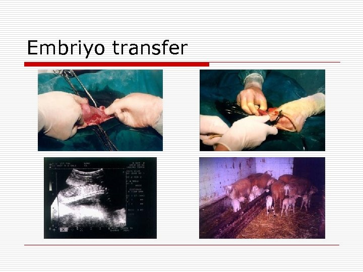 Embriyo transfer 