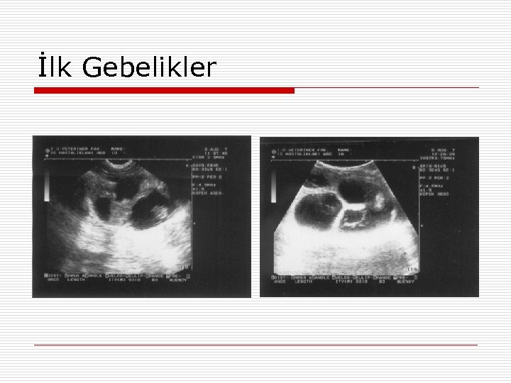 İlk Gebelikler 