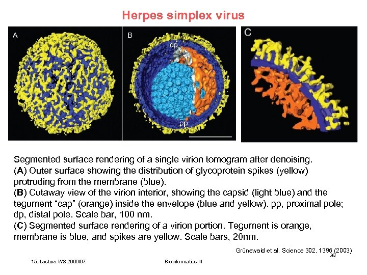 Herpes simplex virus Segmented surface rendering of a single virion tomogram after denoising. (A)