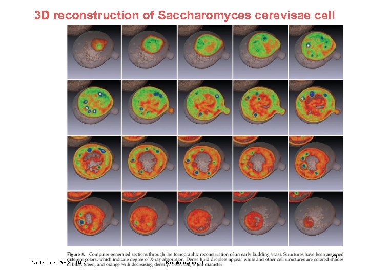 3 D reconstruction of Saccharomyces cerevisae cell Larabell et al. Mol. Biol. Cell 15,