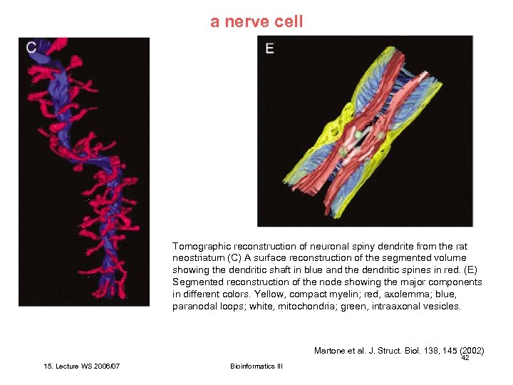 a nerve cell Tomographic reconstruction of neuronal spiny dendrite from the rat neostriatum (C)