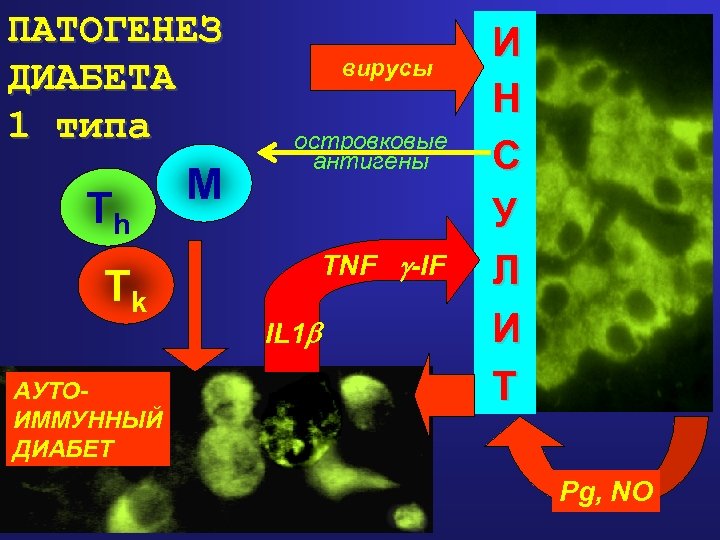 ПАТОГЕНЕЗ ДИАБЕТА 1 типа Th Tk АУТОИММУННЫЙ ДИАБЕТ M вирусы островковые антигены TNF -IF
