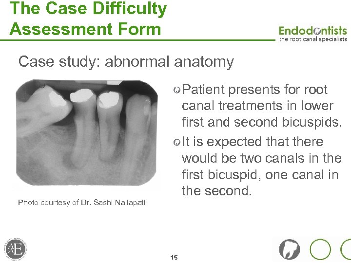 The Case Difficulty Assessment Form Case study: abnormal anatomy Patient presents for root canal