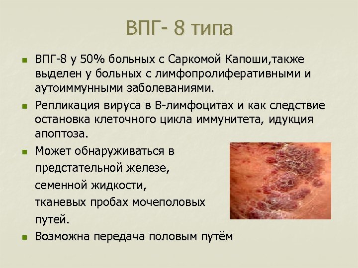 ВПГ- 8 типа n n ВПГ-8 у 50% больных с Саркомой Капоши, также выделен