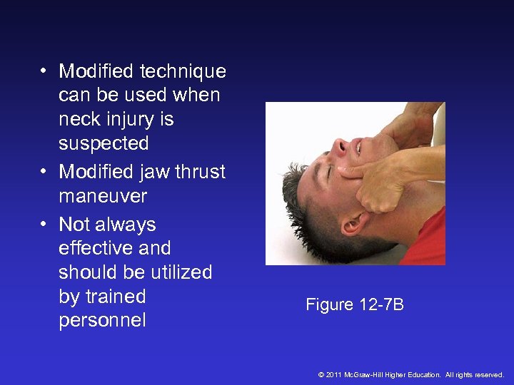  • Modified technique can be used when neck injury is suspected • Modified