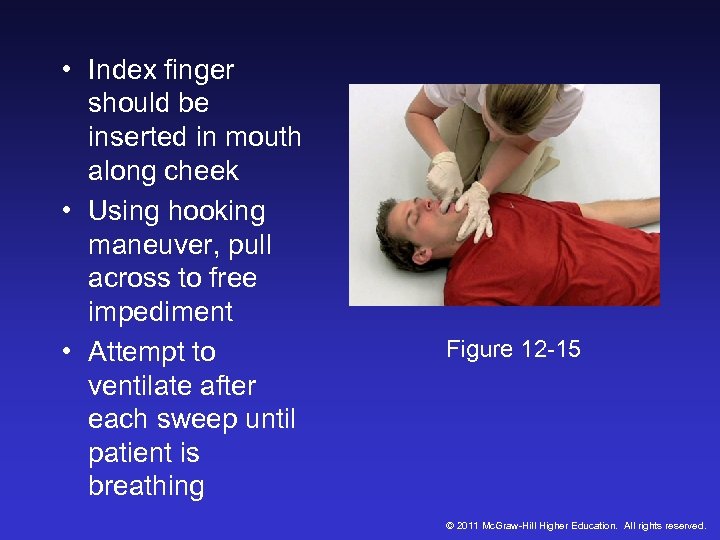  • Index finger should be inserted in mouth along cheek • Using hooking