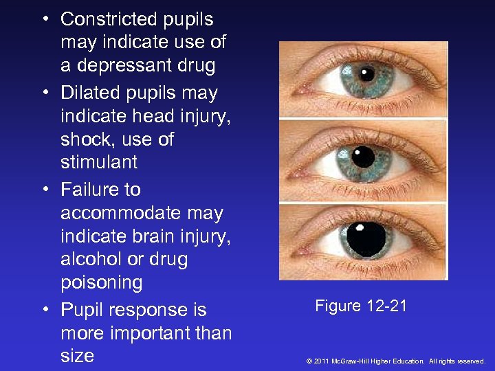  • Constricted pupils may indicate use of a depressant drug • Dilated pupils