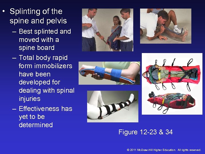  • Splinting of the spine and pelvis – Best splinted and moved with