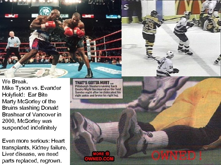 We Break. Mike Tyson vs. Evander Holyfield: Ear Bite Marty Mc. Sorley of the