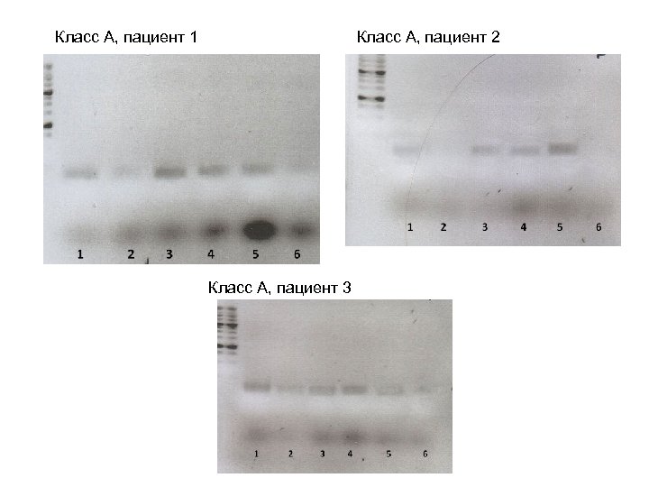 Класс А, пациент 1 Класс А, пациент 2 Класс А, пациент 3 
