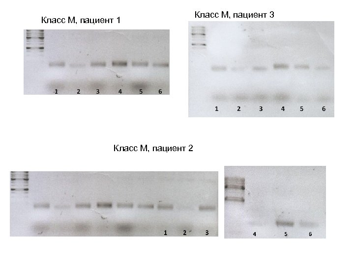 Класс М, пациент 1 Класс М, пациент 2 Класс М, пациент 3 