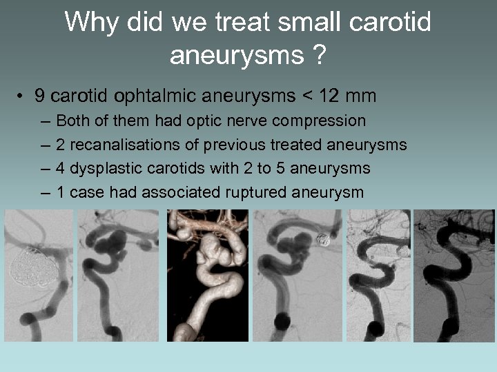Why did we treat small carotid aneurysms ? • 9 carotid ophtalmic aneurysms <
