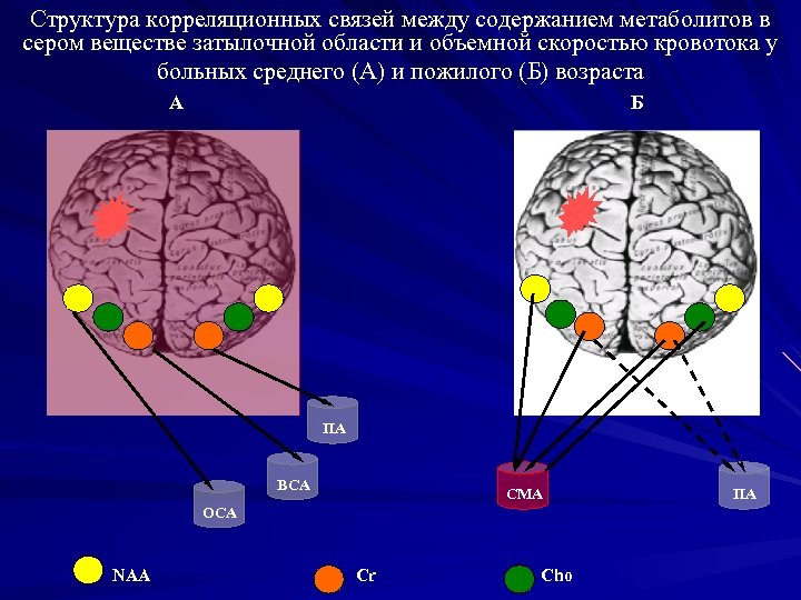 Структура корреляционных связей между содержанием метаболитов в сером веществе затылочной области и объемной скоростью