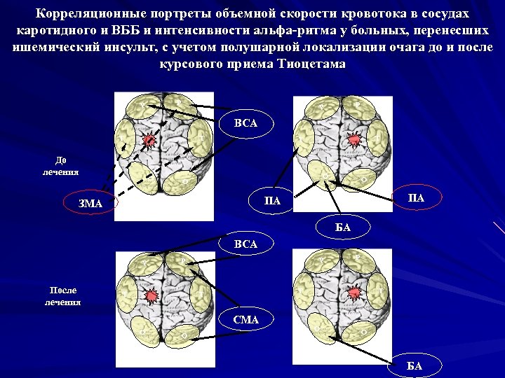 Корреляционные портреты объемной скорости кровотока в сосудах каротидного и ВББ и интенсивности альфа-ритма у