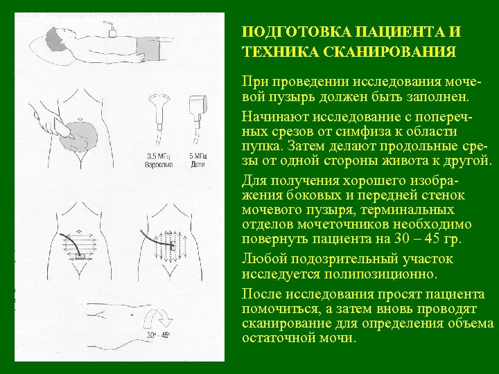 ПОДГОТОВКА ПАЦИЕНТА И ТЕХНИКА СКАНИРОВАНИЯ При проведении исследования мочевой пузырь должен быть заполнен. Начинают