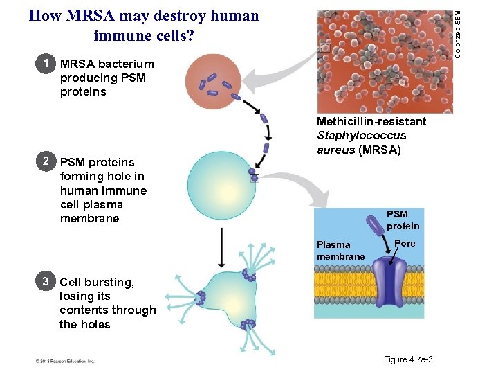 Colorized SEM How MRSA may destroy human immune cells? 1 MRSA bacterium producing PSM