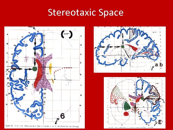 Stereotaxic Space 