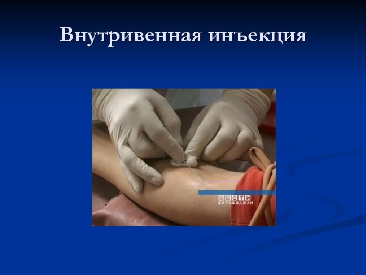 Внутривенная инъекция 