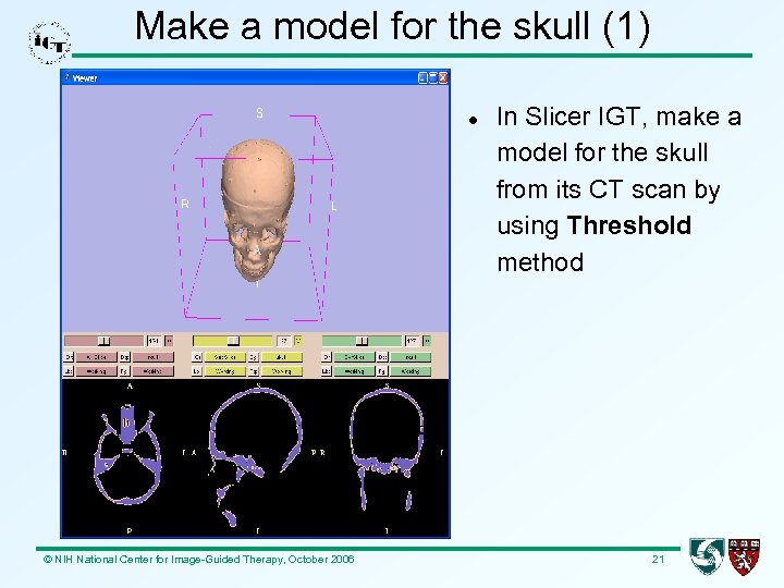 Make a model for the skull (1) © NIH National Center for Image-Guided Therapy,