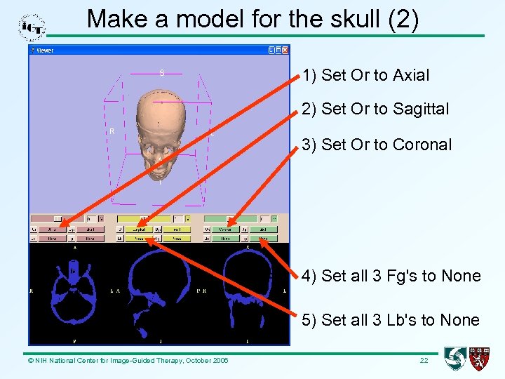 Make a model for the skull (2) 1) Set Or to Axial 2) Set
