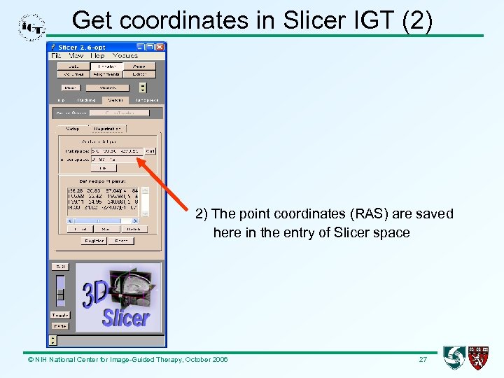 Get coordinates in Slicer IGT (2) 2) The point coordinates (RAS) are saved here