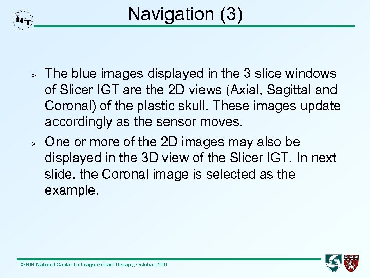 Navigation (3) The blue images displayed in the 3 slice windows of Slicer IGT