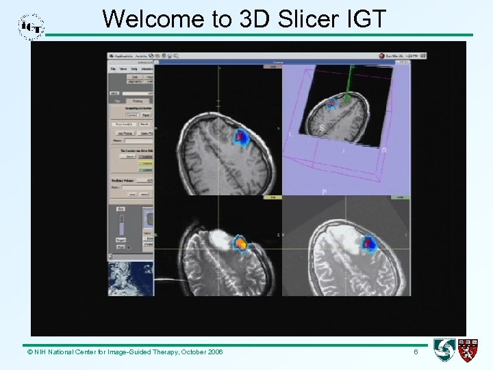 Welcome to 3 D Slicer IGT © NIH National Center for Image-Guided Therapy, October